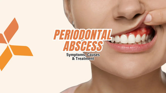 Periodontal Abscess - Symptoms, Causes & Treatment